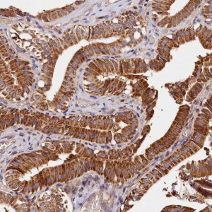 Anti-KPTN antibody produced in rabbit 