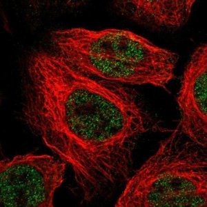 Anti-KRBA2 antibody produced in rabbit 
