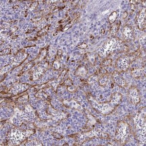 Anti-KRIT1 antibody produced in rabbit 