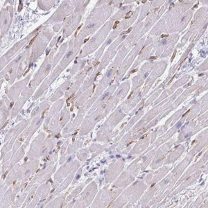 Anti-KRIT1 antibody produced in rabbit 