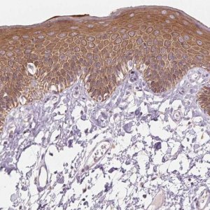 Anti-KRT1 antibody produced in rabbit 