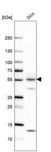 Anti-KRT1 antibody produced in rabbit 