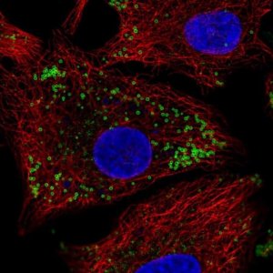 Anti-KRT222 antibody produced in rabbit 
