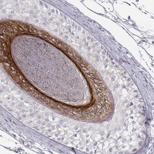 Anti-KRT26 antibody produced in rabbit 