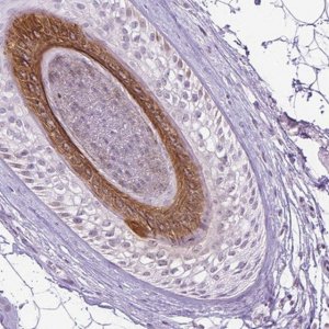 Anti-KRT27 antibody produced in rabbit 