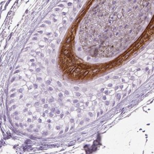 Anti-KRT28 antibody produced in rabbit 