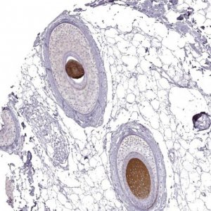 Anti-KRT31 antibody produced in rabbit 