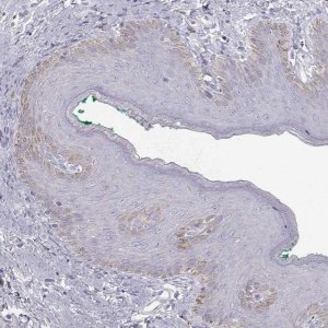 Anti-KRT31 antibody produced in rabbit 
