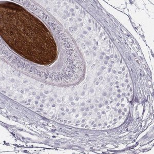 Anti-KRT34 antibody produced in rabbit 
