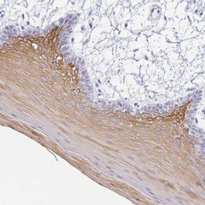 Anti-KRT4 antibody produced in rabbit HPA034881-100UL