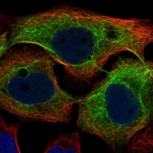 Anti-KRT4 antibody produced in rabbit HPA034881-100UL