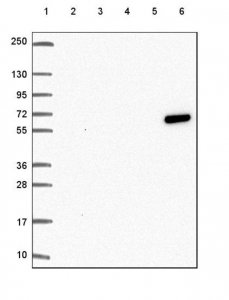 Anti-KRT6A antibody produced in rabbit 