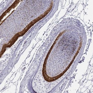 Anti-KRT71 antibody produced in rabbit 
