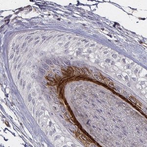 Anti-KRT73 antibody produced in rabbit 