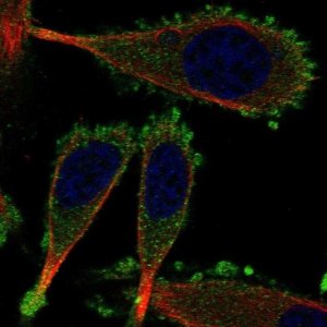 Anti-KRT75 antibody produced in rabbit 