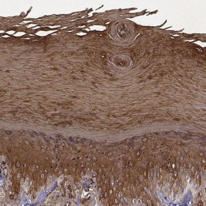 Anti-KRT9 antibody produced in rabbit 