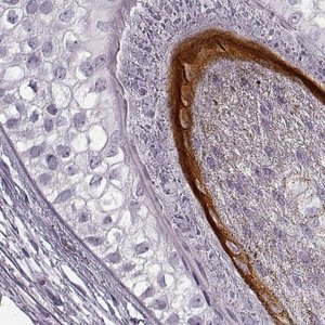 Anti-KRTAP16-1 antibody produced in rabbit 