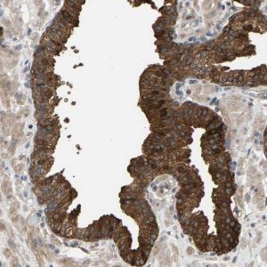 Anti-KRTAP27-1 antibody produced in rabbit 