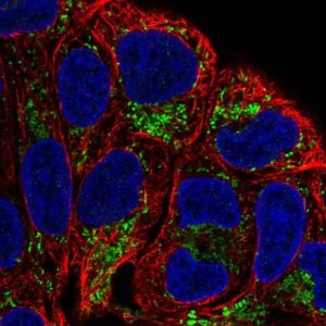 Anti-L2HGDH antibody produced in rabbit 