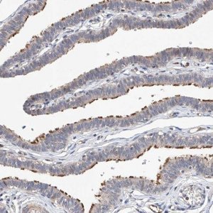Anti-LACE1 antibody produced in rabbit 