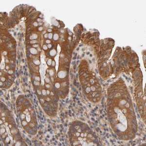 Anti-LAMTOR2 antibody produced in rabbit 