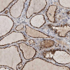 Anti-LAMTOR3 antibody produced in rabbit HPA026858-100UL