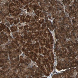 Anti-LAMTOR5 antibody produced in rabbit 