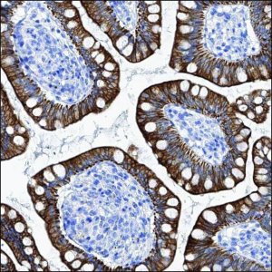 Anti-LARGE antibody produced in rabbit HPA028878-100UL