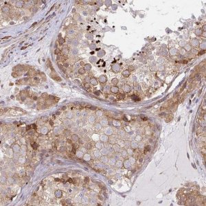 Anti-LARP1 antibody produced in rabbit 