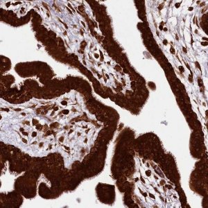 Anti-LARP4 antibody produced in rabbit 