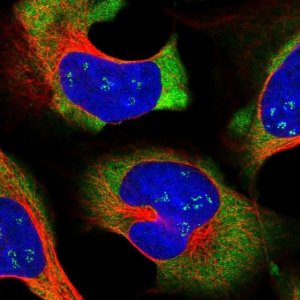 Anti-LARP4 antibody produced in rabbit 