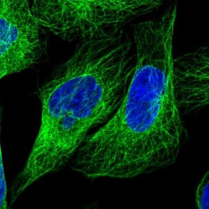 Anti-LARP6 antibody produced in rabbit 