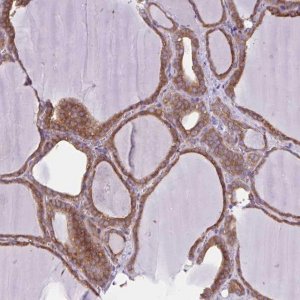 Anti-LARS antibody produced in rabbit HPA040881-100UL