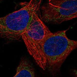Anti-LARS2 antibody produced in rabbit 