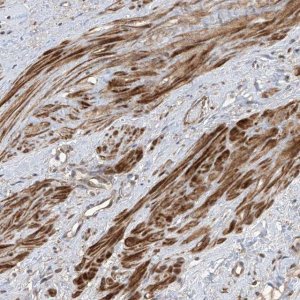 Anti-LATS1 antibody produced in rabbit 