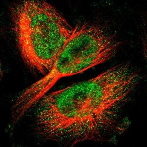 Anti-LBHD1 antibody produced in rabbit 