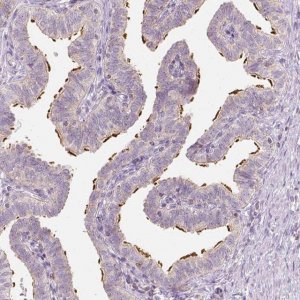 Anti-LCA5 antibody produced in rabbit 