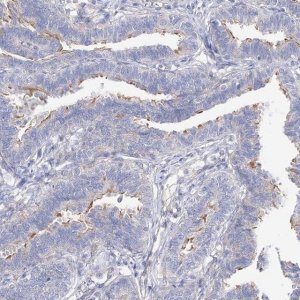 Anti-LCA5 antibody produced in rabbit HPA029053-100UL