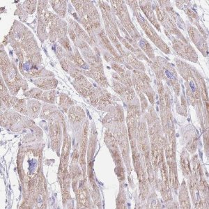 Anti-LCLAT1 antibody produced in rabbit 