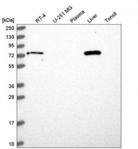 Anti-LCMT2 antibody produced in rabbit HPA048176-100UL