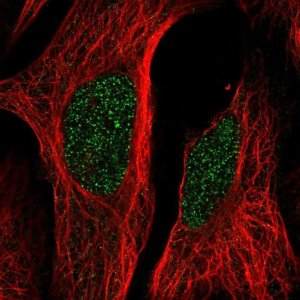 Anti-LCOR antibody produced in rabbit 