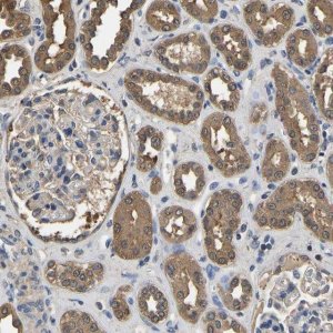 Anti-LDHB antibody produced in rabbit HPA019007-100UL