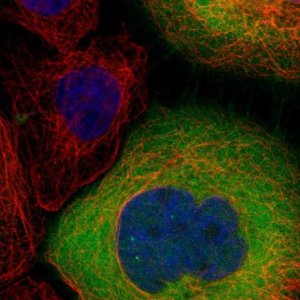 Anti-LDHB antibody produced in rabbit HPA019007-100UL