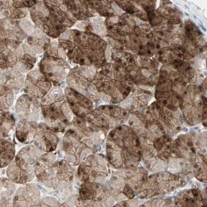 Anti-LDOC1L antibody produced in rabbit 