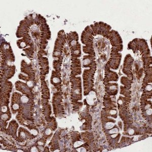 Anti-LGALS9 antibody produced in rabbit 