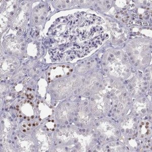 Anti-LHX1 antibody produced in rabbit 
