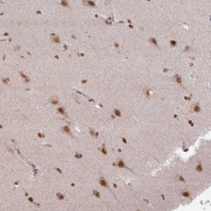 Anti-LHX5 antibody produced in rabbit 