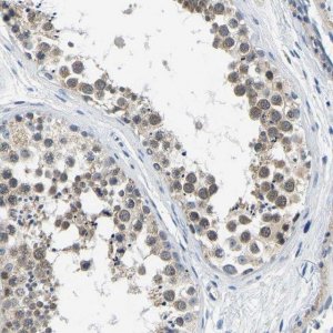 Anti-LIAS antibody produced in rabbit 