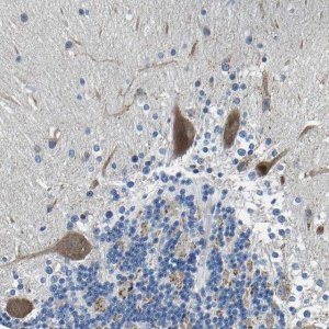 Anti-LIAS antibody produced in rabbit 