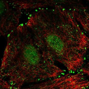 Anti-LIMD1 antibody produced in rabbit 